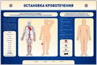 Электрифицированный стенд-тренажер "Остановка кровотечения" - fgospostavki.ru - Мегион