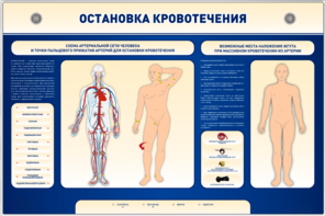 Электрифицированный стенд-тренажер "Остановка кровотечения" - fgospostavki.ru - Мегион